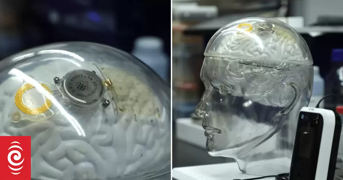 中国、脑机接口技术与Neuralink：一场通向未来的竞赛？