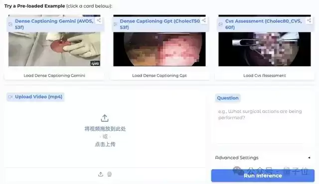 全球首个医疗视频理解大模型开源！6k+组精标测试集与英雄榜同步上线，开发者速来！