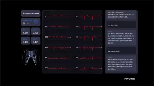 让传统纸质心电图“活”起来!VITURE携手智源研究院发布全新XR AI 数字医疗应用