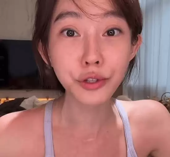 冯提莫直播承认整容!自嘲“像被菜刀割过”